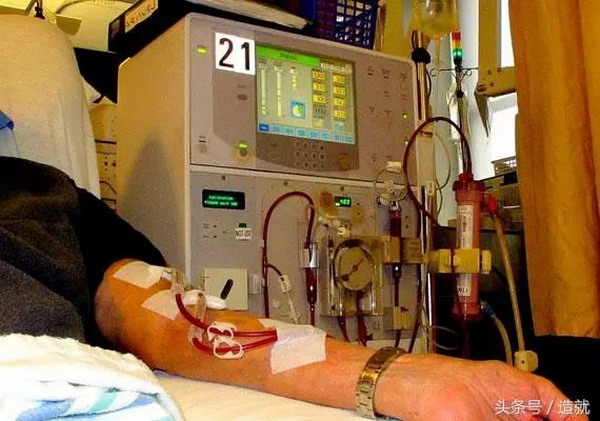 美科学家发明出植入式人工肾脏宣告血液透析即将终结