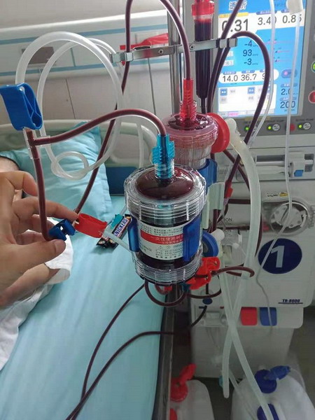 设备先进技术精良安徽静安医院血液透析中心驱散阴霾