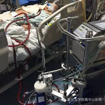 了不起的“叶克膜”危急时刻让心肺衰竭患者起死回生 了不起的“叶克膜”危急时刻让心肺衰竭患者起死回生