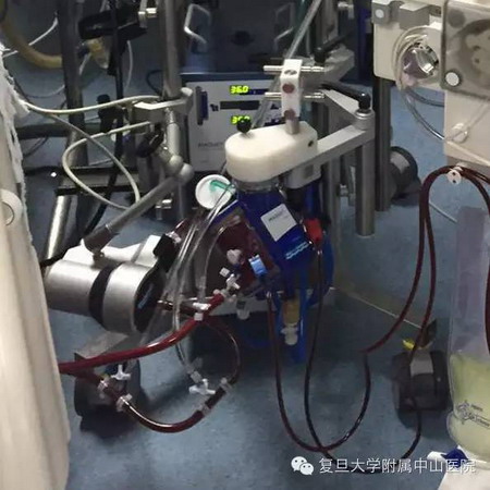 了不起的“叶克膜”危急时刻让心肺衰竭患者起死回生 了不起的“叶克膜”危急时刻让心肺衰竭患者起死回生