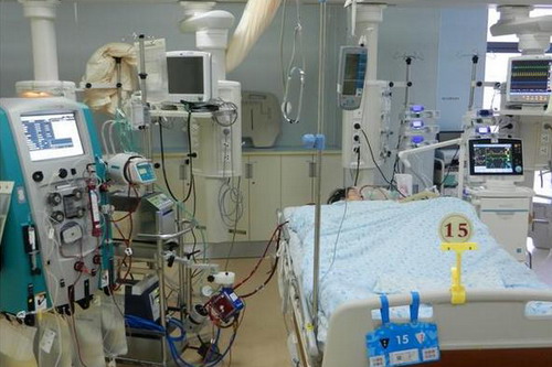 ECMO是体外膜肺氧合(extracorporeal membrane oxygenation)的英文简称 ECMO是体外膜肺氧合(extracorporeal membrane oxygenation)的英文简称