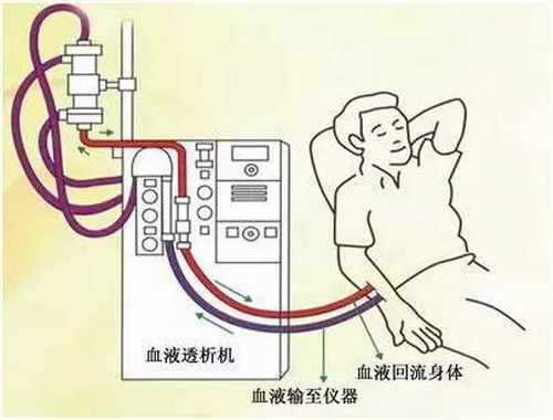 血透内瘘修护仪 血透内瘘修护仪