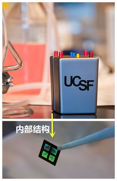 李嘉华:终末期肾友引颈期盼的人工肾离我们还有多远 李嘉华:终末期肾友引颈期盼的人工肾离我们还有多远
