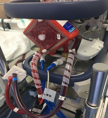 全球最先进的“叶克膜”——MAQUET CARDIOHELP系列 全球最先进的“叶克膜”——MAQUET CARDIOHELP系列