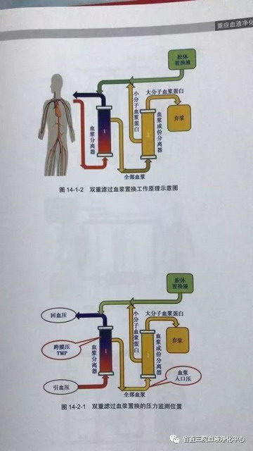 省直三院血液净化中心成功开展首例双重血浆置换技术 省直三院血液净化中心成功开展首例双重血浆置换技术
