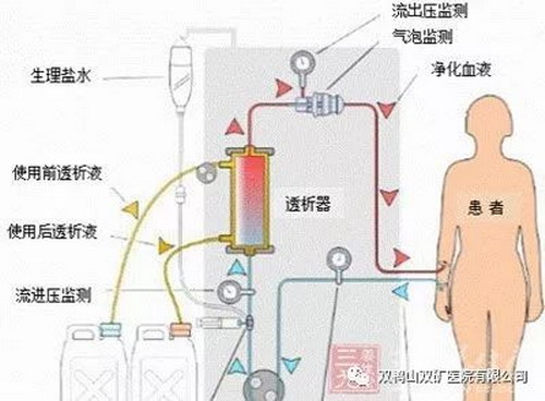 良好的透析治疗让一位加拿大患者创出吉尼斯世界纪录 良好的透析治疗让一位加拿大患者创出吉尼斯世界纪录