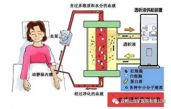 良好的透析治疗让一位加拿大患者创出吉尼斯世界纪录 良好的透析治疗让一位加拿大患者创出吉尼斯世界纪录