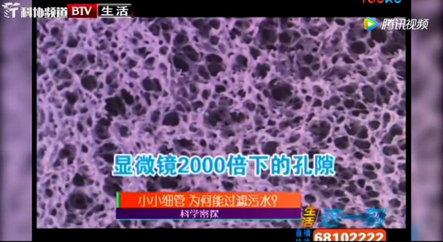 与清华大学王晓琳教授一起触摸TIPS法中空纤维膜内芯 与清华大学王晓琳教授一起触摸TIPS法中空纤维膜内芯